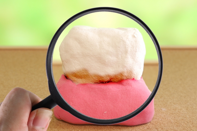 歯の変色や色素沈着が気になる時は？